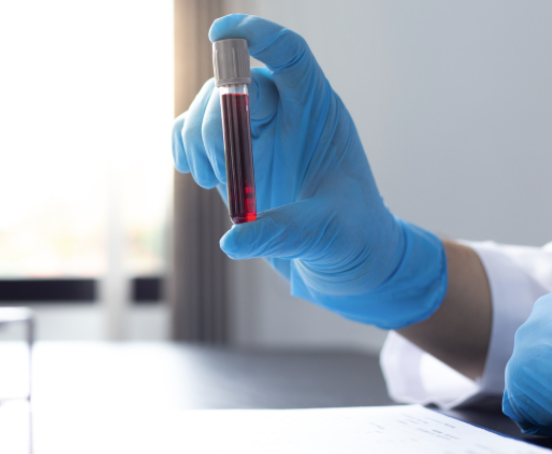 Ręka w rękawiczce trzymająca próbkę z krwią.